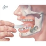 Pathology of Mouth and Jaws