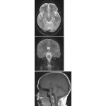 Cranial Imaging (MRI)