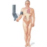 Specific Causes of Hypertension to be Ruled Out