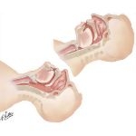Anatomy of Opening Airway