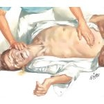 Relief of Distention
