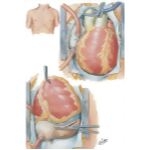 Operative Procedure
