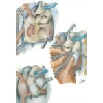 Operative Procedure