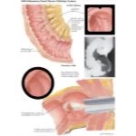 Labeled image