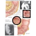Labeled image
