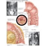 Labeled image