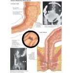 Labeled image