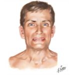 Temporomandibular Joint Pain
