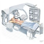 Angiography