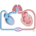 Congestive Heart Failure; Schematic #2