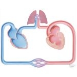 Congestive Heart Failure; Schematic #3