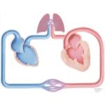 Congestive Heart Failure; Schematic #5