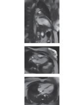 Magnetic Resonance Imaging of the Heart In Arbitrary Orientation