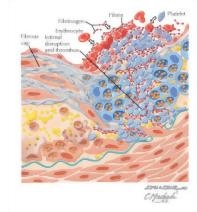 Runge Cardiology 2E image
