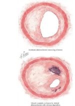 Runge Cardiology 2E image