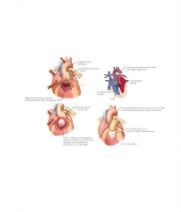 Runge Cardiology 2E image