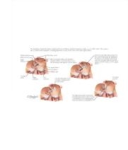 Runge Cardiology 2E image