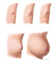 Normal Puberty