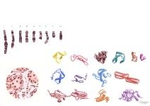 Sex Determination Genes and Chromosomes