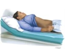 Toxic Shock Syndrome