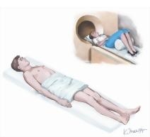 Roentgenologic Examination of Lungs