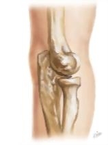 Cross Section Reference Elbow: Coronal