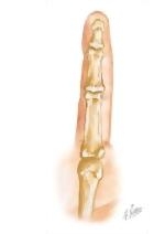 Cross Section Reference Finger: Axial - Sagittal