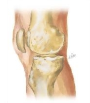 Cross Section Reference Knee: Coronal