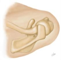 Cross Section Reference Shoulder: Coronal - Sagittal