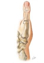 Cross Section Reference Thumb: Sagittal