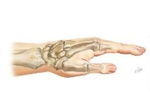 Cross Section Reference Wrist: Coronal