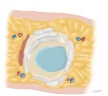 Cross Section of the Hand: Axial View