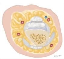 Cross Section of the Hand: Axial View