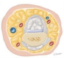 Cross Section of the Hand: Axial View