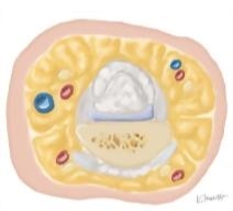 Cross Section of the Hand: Axial View