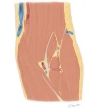 Cross Section of the Elbow: Coronal View