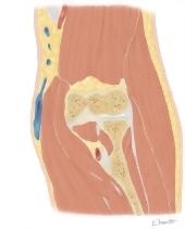 Cross Section of the Elbow: Coronal View