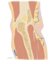 Elbow Coronal 7