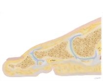 Cross Section of the Plantar Plate: Sagittal View
