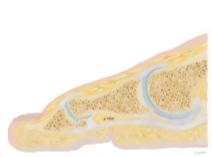 Cross Section of the Plantar Plate: Sagittal View