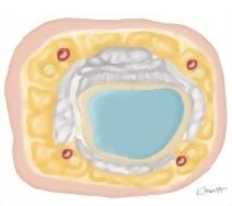 Cross Section of the Hand: Axial View