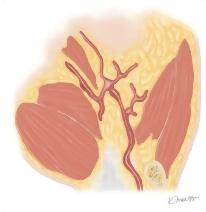 Cross Section of the Hand: Coronal View