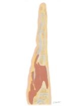 Cross Section of the Hand: Coronal View
