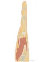 Cross Section of the Hand: Coronal View