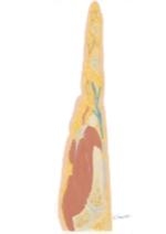 Cross Section of the Hand: Coronal View