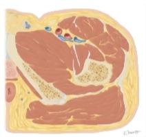 Cross Section of the Hip: Axial View