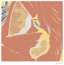 Cross Section of the Hip: Coronal Oblique View