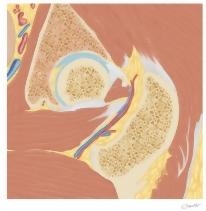 Cross Section of the Hip: Coronal Oblique View