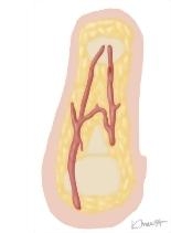 Cross Section of the Thumb: Coronal View