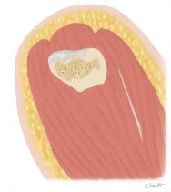 Cross Section of the Shoulder: Sagittal View
